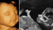 Ohio announces State law to protect unborn babies. Photo credit to The Freedom Times compilation with Window To The Womb, Society 6.